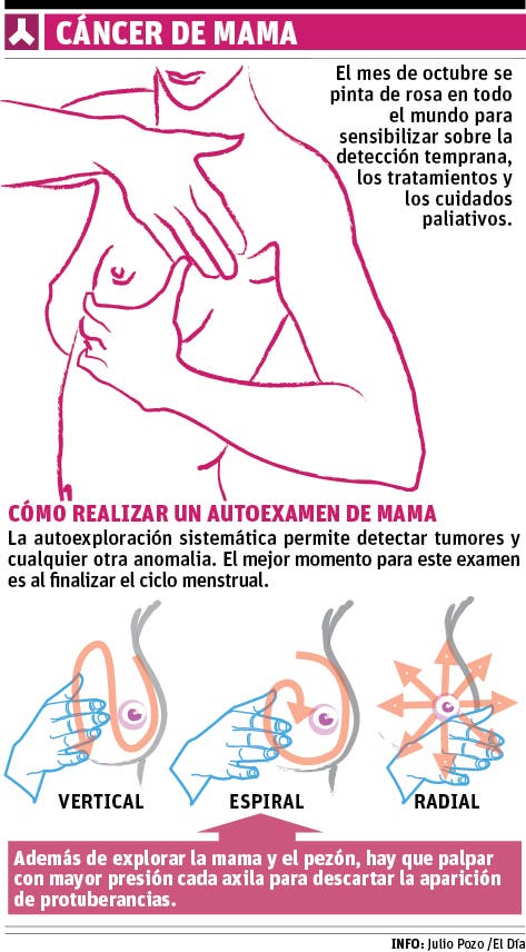 info-cancer-de-mama-ii