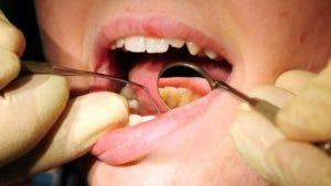 Dentista debe pagarle a su madre casi US$1 millón por haberle financiado su carrera