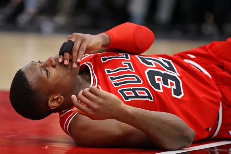 Jugador de los Chicago Bulls se disloca dos diantes al hacer donqueo y caer al piso