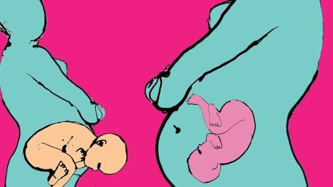 ¿Pueden las duchas vaginales mejorar la salud de los bebés que nacen por cesárea?