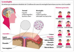 Las secuelas de la meningitis: mal con una alta tasa de  mortalidad