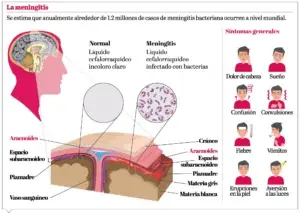 Las secuelas de la meningitis: mal con una alta tasa de  mortalidad