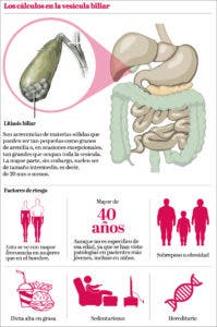 info-vesicula-biliar