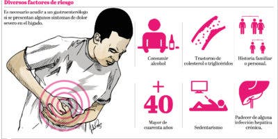 La esteatosis hepática o el “hígado graso” afecta 46 % de la población