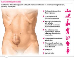 Cómo debe ser el abordaje de las hernias ventrales incisionales