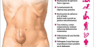 Cómo debe ser el abordaje de las hernias ventrales incisionales