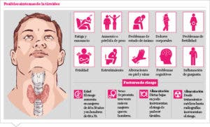 Trastornos de la tiroides afecta 10 % de la población mundial