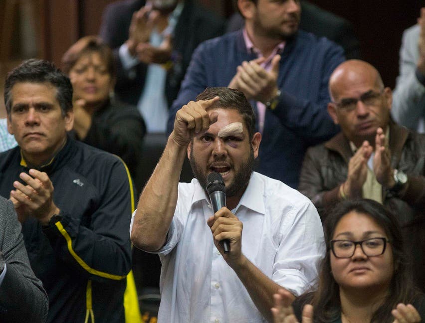 Detención de congresista opositor desata tensiones en Venezuela