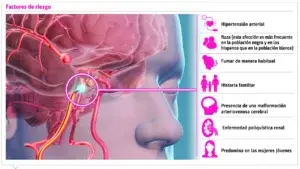 Cuidado con los aneurismas cerebrales pueden ser fatales