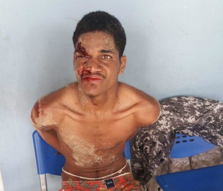 Joven de 22 años mata a puñaladas a su madrastra en Higüey