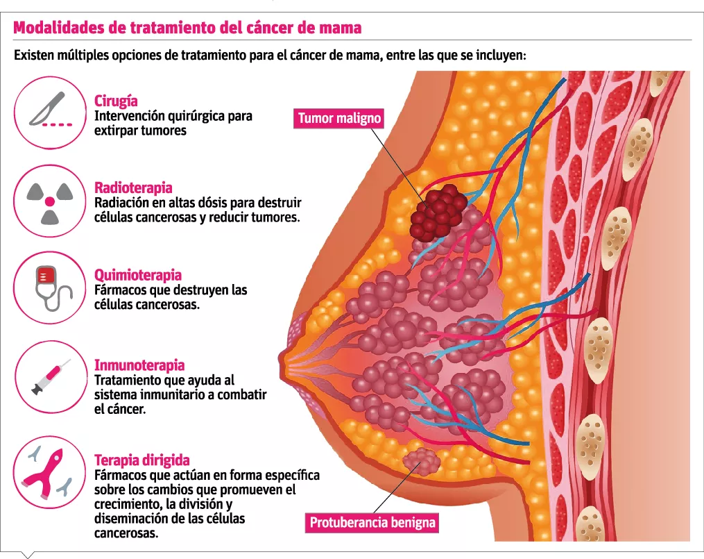 info-tratamiento-cancer-de-mama