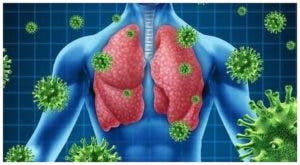 Automedicación cuando hay infección respiratoria puede derivar en neumonías