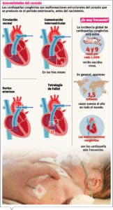 Las cardiopatías congénitas en la edad pediátrica