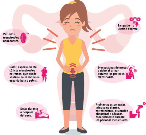 La endometriosis y su impacto en la fertilidad mujeres edad productiva