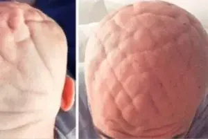 Hombre tiene la cabeza en forma de cerebro