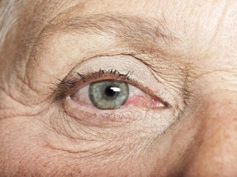 Ojo seco es una afectación que aqueja a mujeres durante la menopausia