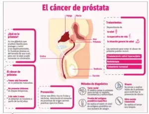 Vigilar sin tratar, otra opción para evitar agravamiento en cáncer de próstata