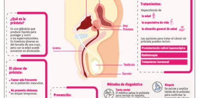 Vigilar sin tratar, otra opción para evitar agravamiento en cáncer de próstata