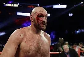 Tyson Fury  impacta como ciclón la WWE