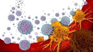 Cáncer de próstata: el innovador tratamiento que puede combatir uno de los tipos de cáncer más comunes entre los hombres