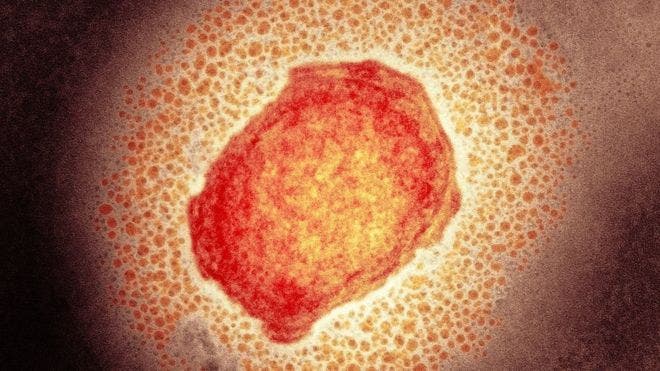 Qué es la «viruela de los monos», la rara infección que descubrieron en un paciente en Reino Unido