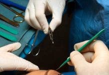 Salud Pública plantea fortalecer las normas regulan las cirugías