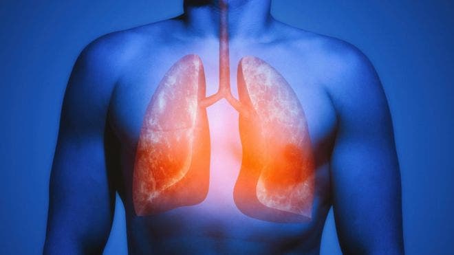 La extraordinaria habilidad de los pulmones para reparar el daño causado por fumar (solo si dejas de hacerlo)