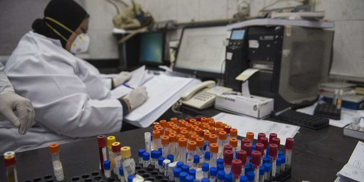Dos laboratorios privados del país pueden diagnosticar el Covid-19
