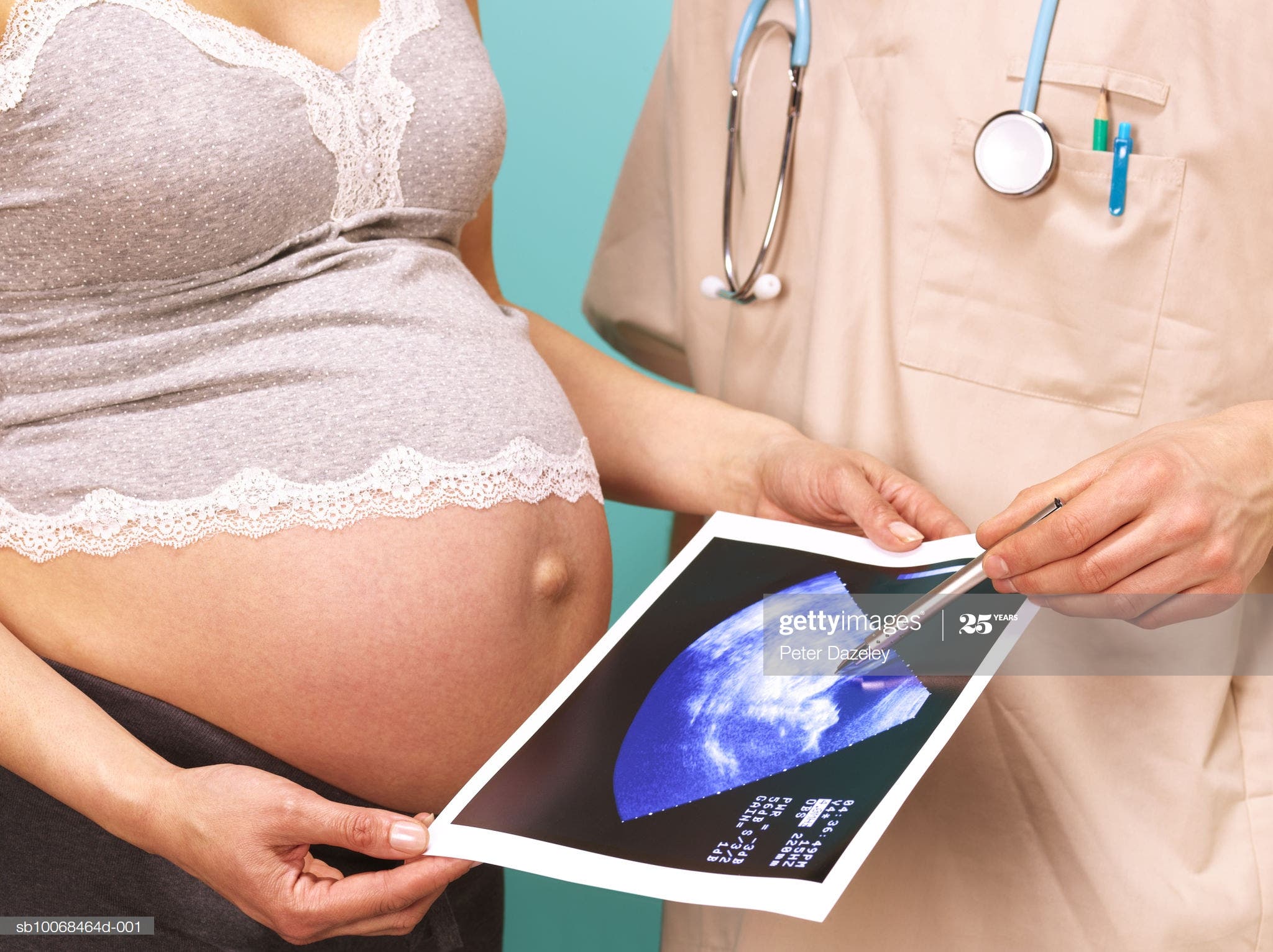 Menos consultas prenatales, una posible causa en aumento muertes maternas