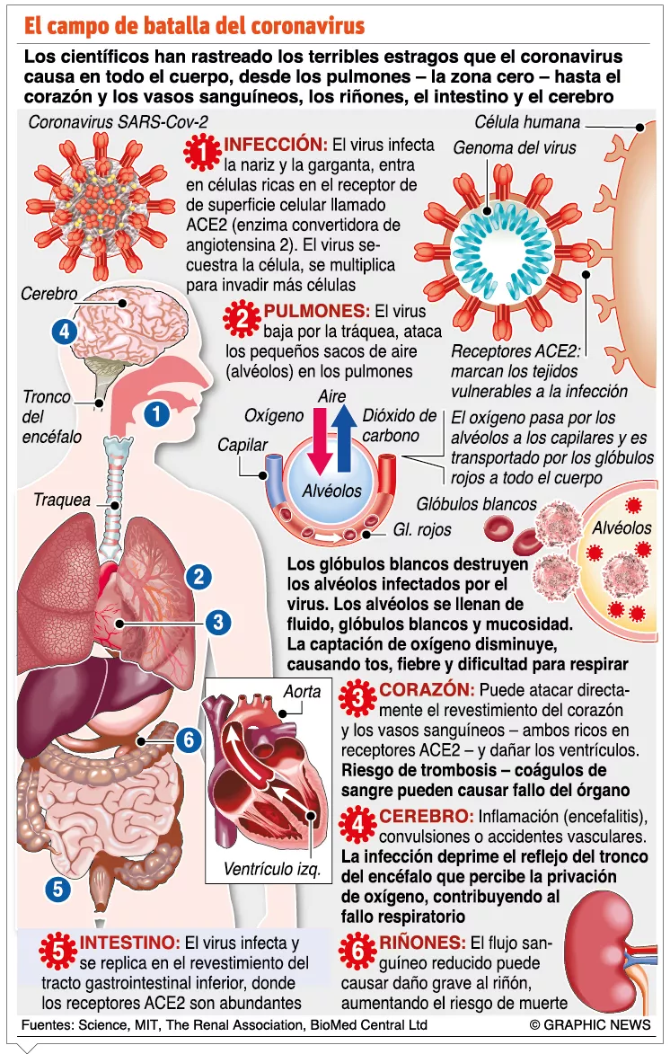 La OPS alerta brote Covid-19 de gran magnitud en Haití