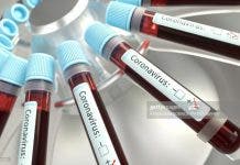 Coronavirus: Sector privado lidera financiación de pruebas PCR