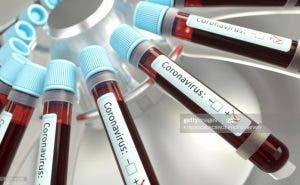 Coronavirus: Sector privado lidera financiación de pruebas PCR