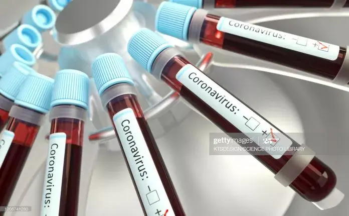 Coronavirus: Sector privado lidera financiación de pruebas PCR