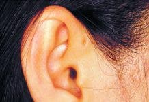 Las malformaciones en el oído ocurren en menos del 1% de niños sanos