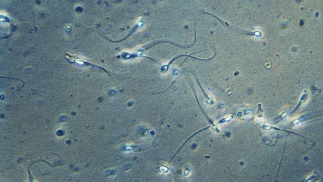 La sorprendente forma en que realmente nadan los espermatozoides