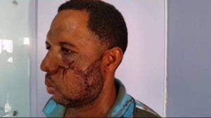 Hombre denuncia fue golpeado por cabo tras ser detenido en cuartel de Puerto Plata