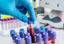 En la sangre se pueden encontrar pistas para conocer  estado de  salud