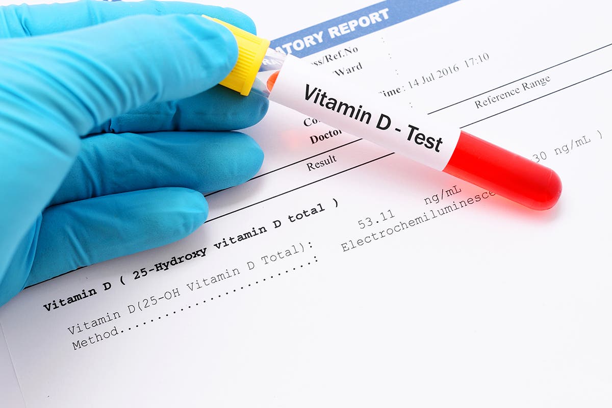 El 82% de pacientes con covid-19 tiene falta de vitamina D, según estudio
