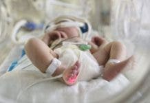 Los nacimientos prematuros son la principal causa de mortalidad infantil