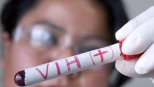 Más de 78,000 personas en el país viven con VIH