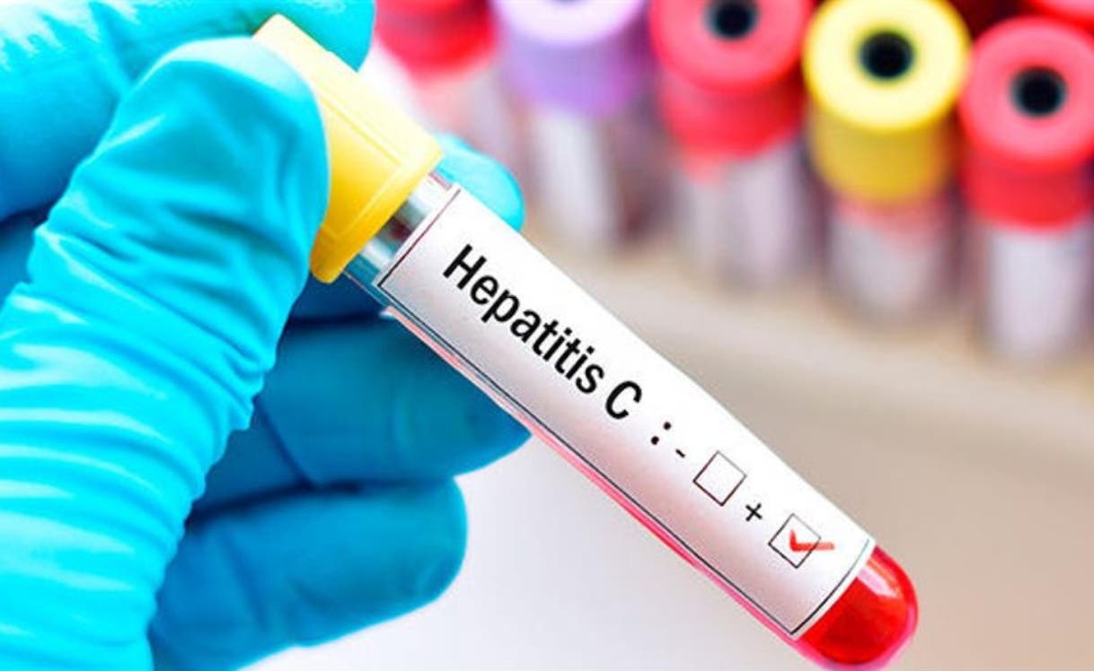 Prueba de Hepatitis C debe ser reglamentaria