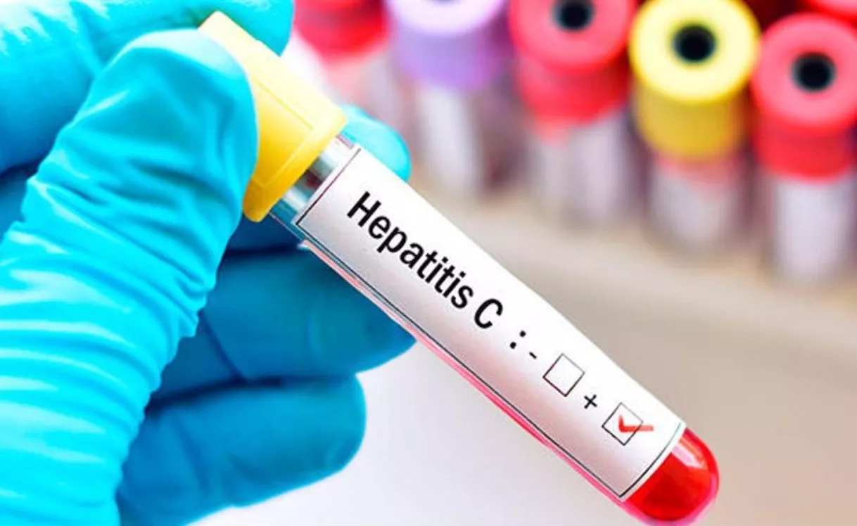 Prueba de Hepatitis C debe ser reglamentaria