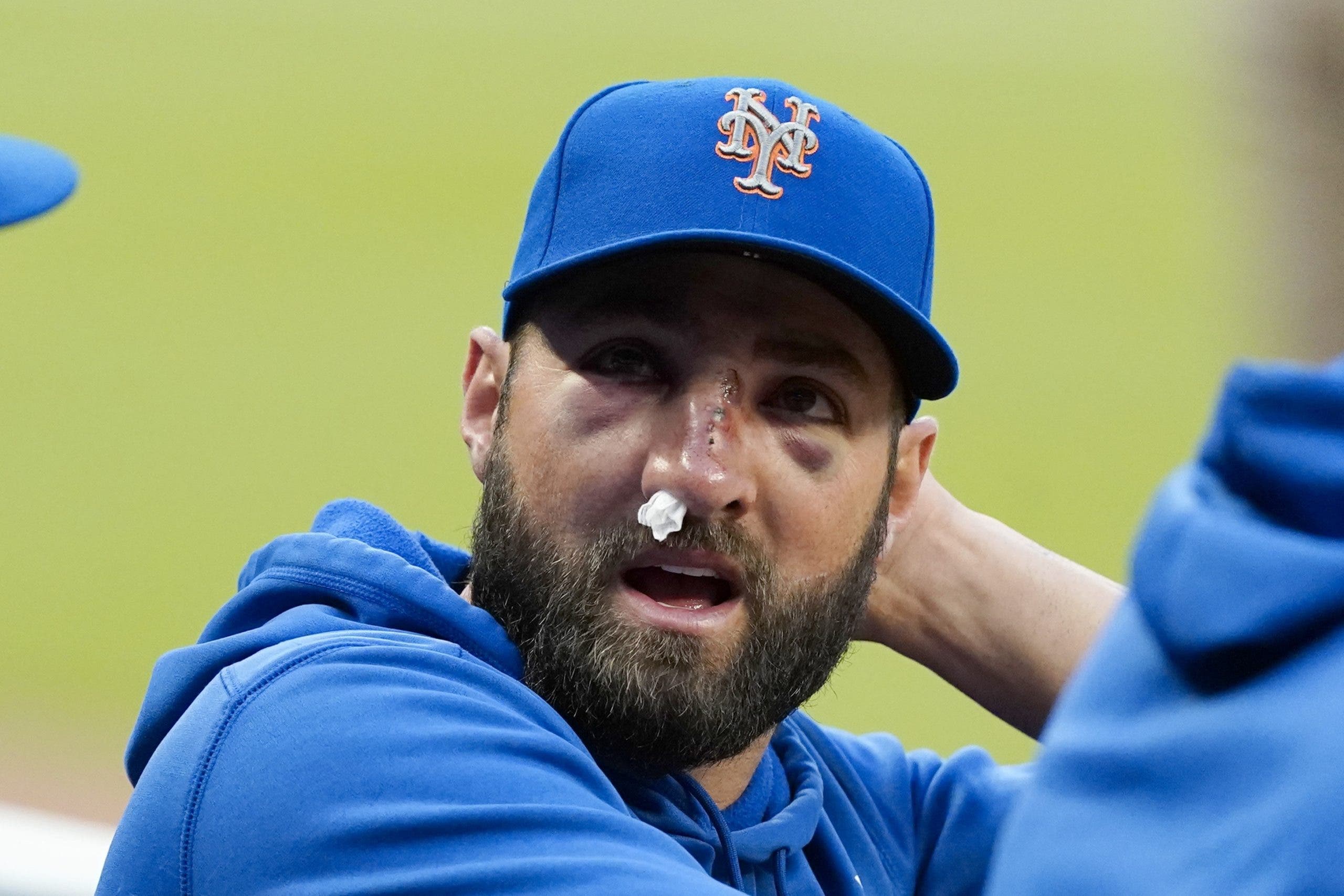 Mets: Kevin Pillar con múltiples fracturas nasales por pelotazo