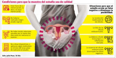 El Papanicolaou, importante en la detección temprana del cáncer cérvico uterino