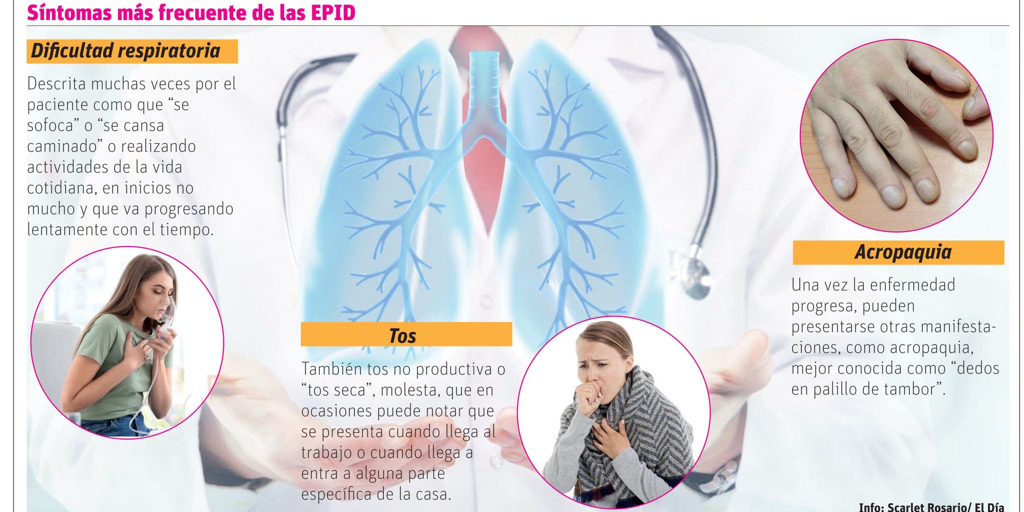 Enfermedades pulmonares  pueden pasar desapercibidas y causar un gran deterioro