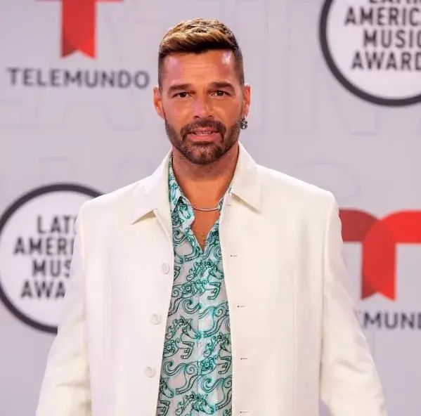 Ricky Martin asegura que no se ha hecho retoques faciales