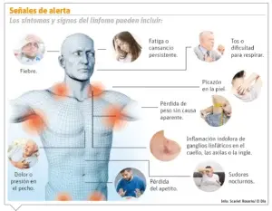 El linfoma, un cáncer que es más común en hombres que en mujeres