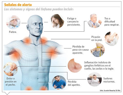 sintomas de cancer de cuello en hombres