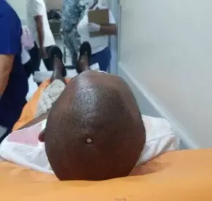 Hombre se martilla clavo en la cabeza y se perfora oreja con una espina en Puerto Plata