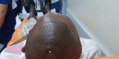 Hombre se martilla clavo en la cabeza y se perfora oreja con una espina en Puerto Plata